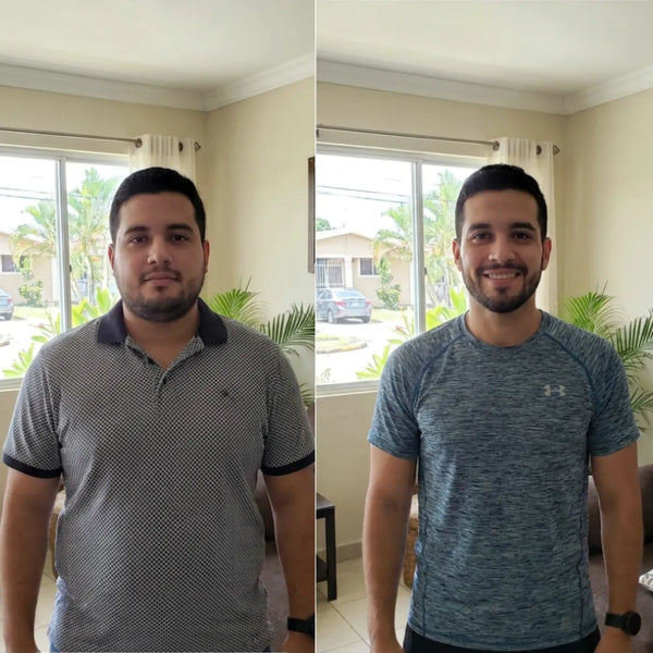Skin Transformation